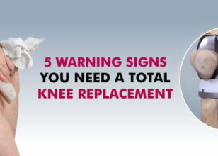 5 signs you may need knee replacement surgery