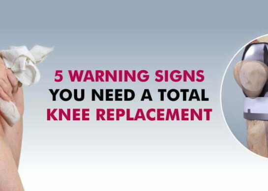 5 signs you may need knee replacement surgery